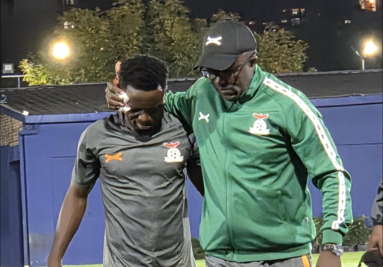 Zambia vs Argentina: Prince Mumba suffers facial injury
